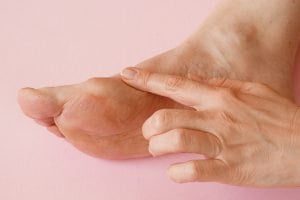 Can bunions be reversed?